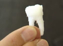 کاشت ایمپلنت های دندانی با سلول های بنیادی