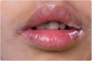 حساسیت به محصولات بهداشتی دهان و دندان