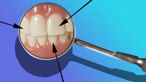 نخ دندان کشیدن قبل یا بعد از مسواک زدن؟