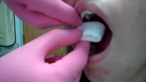 خونریزی  بعد از کشیدن دندان